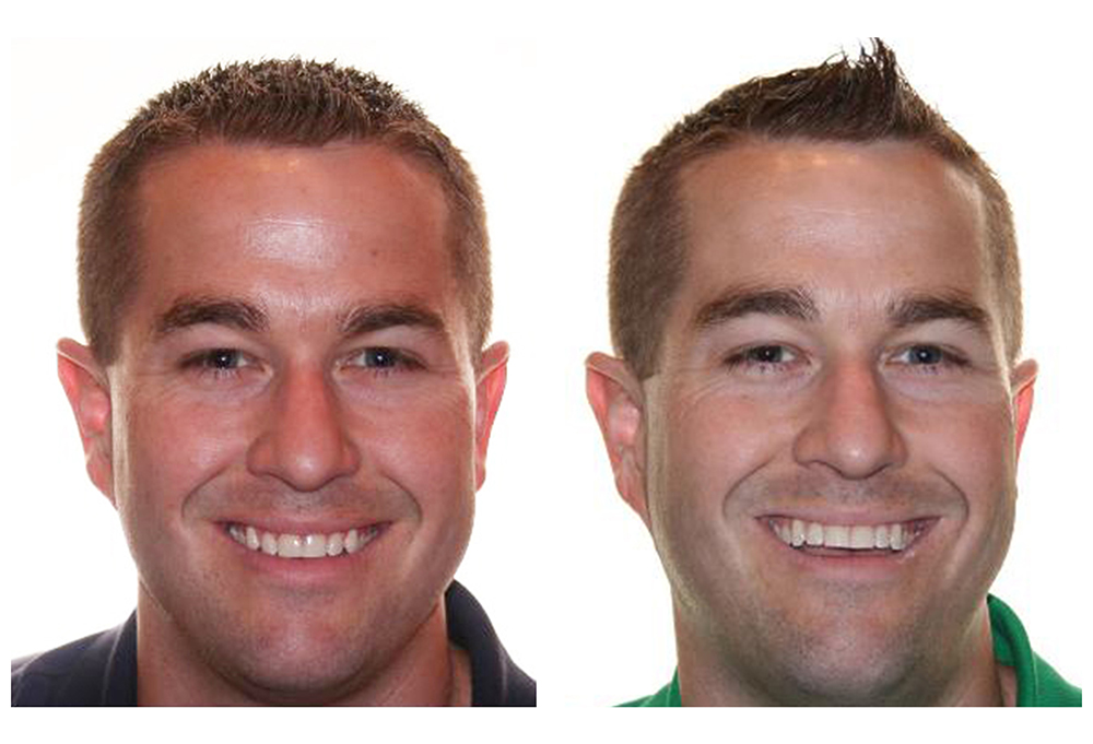 Dr. Fiorenti s Orthodontics