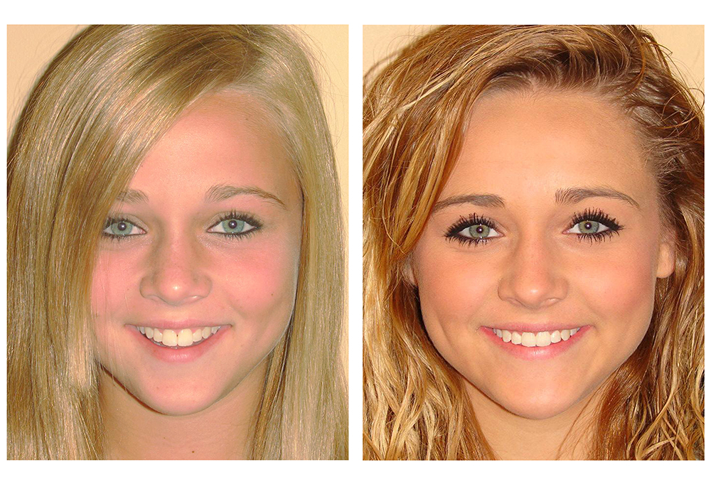 Dr. Fiorenti s Orthodontics