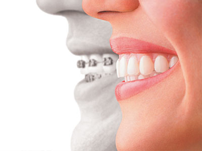 The image is a composite photograph showing two individuals, one with a full set of teeth and the other with a partial set, merged together to represent dental health.